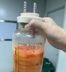 温县水动力吸脂手术要做多久？
